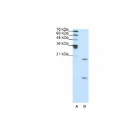 Antibody used in WB on Human HepG2 at 1 ug/ml.