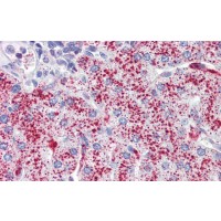 Antibody used in IHC on Human Liver at 5.0 ug/ml.