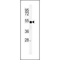 Western blot analysis of SP5 Antibody in mouse liver tissue lysates (35ug/lane)