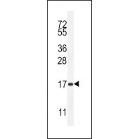 Western blot analysis in mouse heart tissue lysates (35ug/lane).