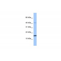 Antibody used in WB on Human Muscle at 0.2-1 ug/ml.