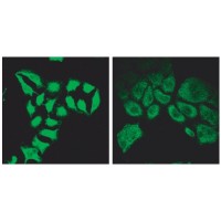 Immunofluorescence (2μg/ml) staining of methanol-fixed HeLa before (left) and after (right) introduction of siRNA.