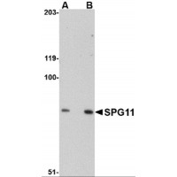 Western blot analysis of SPG11 in mouse heart tissue lysate with SPG11 antibody at (A) 0.5 and (B) 1 μg/mL.
