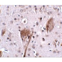 Immunohistochemistry of SPG11 in mouse brain tissue with SPG11 antibody at 2.5 μg/mL.