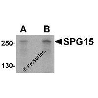 Western blot analysis of SPG15 in K562 cell lysate with SPG15 antibody at (A) 1 and (B) 2 μg/mL.