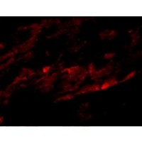 Immunofluorescence of SPG15 in Mouse Heart tissue with SPG15 antibody at 20 μg/mL.