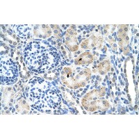 Antibody used in IHC on Human kidney.