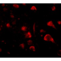 Immunofluorescence of spred3 in human brain tissue with spred3 antibody at 20 μg/mL.