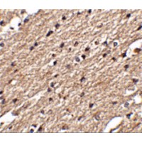 Immunohistochemistry of Spred3 in human brain tissue with Spred3 antibody at 2.5 μg/mL.