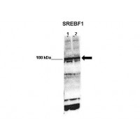 Antibody used in WB on mouse glomerular endothelial at 1:1000 (Lane 1: 50ug mouse glomerular endothelial lysate Lane 2: 50ug mouse glomerular endothelial lysate ).