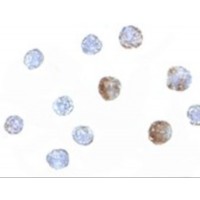 Immunocytochemistry of ST3gal6 in HeLa cells with ST3gal6 antibody at 5 μg/mL.