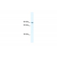 Antibody used in WB on Human at 5.0 ug/ml.