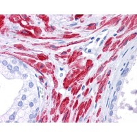 Antibody used in IHC on Human Prostate.