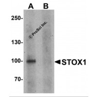 Western blot analysis of STOX1 in human liver tissue lysate with STOX1 antibody at 1 μg/ml in (A) the absence and (B) the presence of blocking peptide.