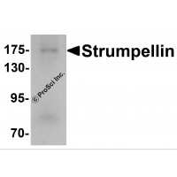 Western blot analysis of Strumpellin in human ovary tissue lysate with Strumpellin antibody at 1 μg/mL.