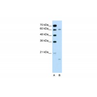 Antibody used in WB on Human Jurkat 0.2-1 ug/ml.