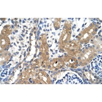 Antibody used in IHC on Human Kidney at 4.0-8.0 ug/ml.