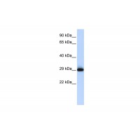 Antibody used in WB on Human Placenta at 0.2-1 ug/ml.
