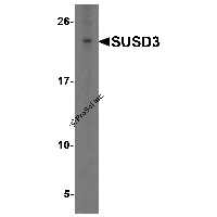 Western blot analysis of SUSD3 in HeLa cell lysate with SUSD3 antibody at 1 μg/ml.