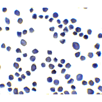 Immunocytochemistry of SUSD3 in 3T3 cells with SUSD3 antibody at 5 μg/ml.