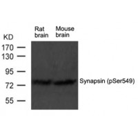 Western blot analysis of extract from rat brain and mouse brain tissue using Synapsin (phospho-Ser549) Antibody.