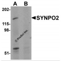 Western blot analysis of SYNPO2 in human skeletal muscle tissue lysate with SYNPO2 antibody at 1 μg/mL in (A) the absence and (B) the presence of blocking peptide.