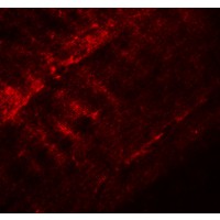 Immunofluorescence of SYNPO2 in mouse skeletal muscle tissue with SYNPO2 antibody at 20 μg/mL.