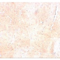 Immunohistochemistry of SYNPO2 in mouse skeletal muscle tissue with SYNPO2 antibody at 5 μg/mL.