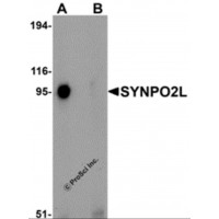 Western blot analysis of SYNPO2L in human thymus tissue lysate with SYNPO2L antibody at 1 μg/mL in (A) the absence and (B) the presence of blocking peptide.