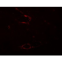 Immunofluorescence of SYNPO2L in mouse skeletal muscle tissue with SYNPO2L antibody at 20 μg/mL.