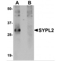 Western blot analysis of SYPL2 in human spleen tissue lysate with SYPL2 antibody at 1 μg/mL in (A) the absence and (B) the presence of blocking peptide.