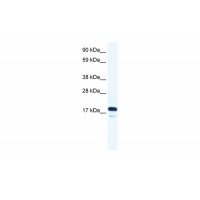Antibody used in WB on Human Small Intestine at 0.125 ug/ml.