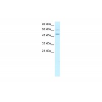 Antibody used in WB on Human Jurkat 0.2-1 ug/ml.