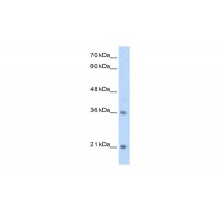 Antibody used in WB on Human Jurkat 2.5 ug/ml.