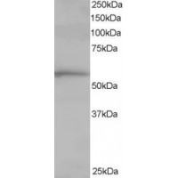 Western Blot staining (1μg/ml) of Human Lung lysate (RIPA buffer, 35μg total protein per lane). Primary incubated for 1 hour. Detected by western blot using chemiluminescence.