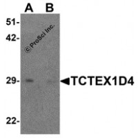 Western blot analysis of TCTEX1D4 in mouse liver tissue lysate with TCTEX1D4 antibody at 1 μg/mL in (A) the absence and (B) the presence of blocking peptide.