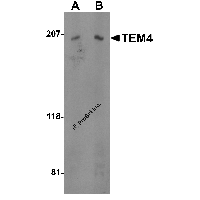 Western blot analysis of TEM4 in Jurkat cell lysate with TEM4 antibody at (A) 0.5 and (B) 1 μg/mL.