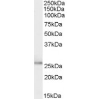 Western Blot (0.1μg/ml) staining of Human Breast cancer lysate (35μg protein in RIPA buffer). Primary incubation was 1 hour. Detected by chemiluminescence.