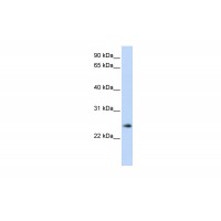 Antibody used in WB on Human Muscle at 0.2-1 ug/ml.