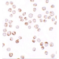 Immunocytochemistry of TIAF in K562 cells with TIAF antibody at 2.5 μg/ml.