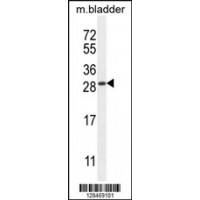 Western blot analysis in mouse bladder tissue lysates (35ug/lane).