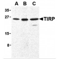 Western blot analysis of TIRP in human (A), mouse (B), and rat (C) kidney cell lysates with TIRP antibody (C2) at 1 μg/mL.