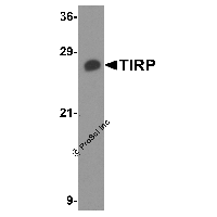 Western blot analysis of TIRP in PC-3 cell lysate with TIRP antibody at 1 μg/mL.