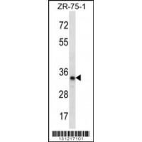 Western blot analysis in ZR-75-1 cell line lysates (35ug/lane).
