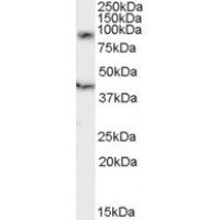 Western Blot (0.2μg/ml) staining of human spleen lysate (35μg protein in RIPA buffer). Primary incubation was 1 hour. Detected by chemiluminescence.