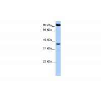 Antibody used in WB on Human Heart at 0.2-1 ug/ml.