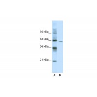 Antibody used in WB on Human Jurkat 0.2-1 ug/ml.