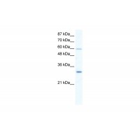 Antibody used in WB on Human Jurkat 2.5 ug/ml.