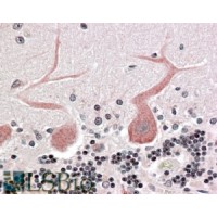 Immunohistochemistry (3.8μg/ml) staining of paraffin embedded Human CerImmunohistochemistry Steamed antigen retrieval with citrate buffer pH 6, AP-staining.