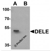Western blot analysis of DELE in rat brain tissue lysate with DELE antibody at 1 μg/ml in (A) the absence and (B) the presence of blocking peptide.